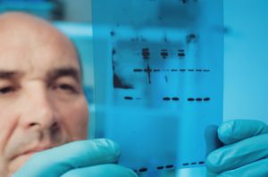 21361915 - scientist checks results of western blot experiment