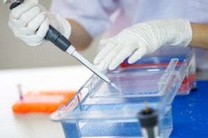 27752010 - woman hand loading samples into  gel for electrophoresis